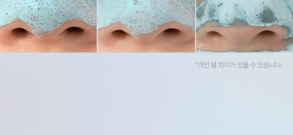 [3분모공청소]메디큐브 제로 모공 블랙헤드 머드팩 100g 상세페이지 7